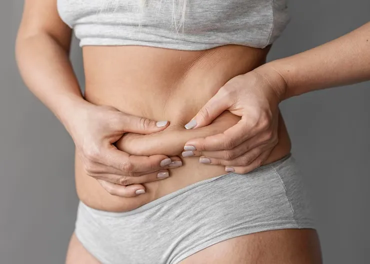 Para quem é indicada a Mini Abdominoplastia?